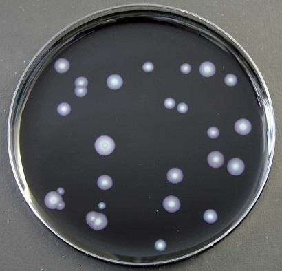 Beeinträchtigungen der Trinkwasserhygiene Biologische Beeinträchtigungen Legionella pneumophila: Erstmals entdeckt bei