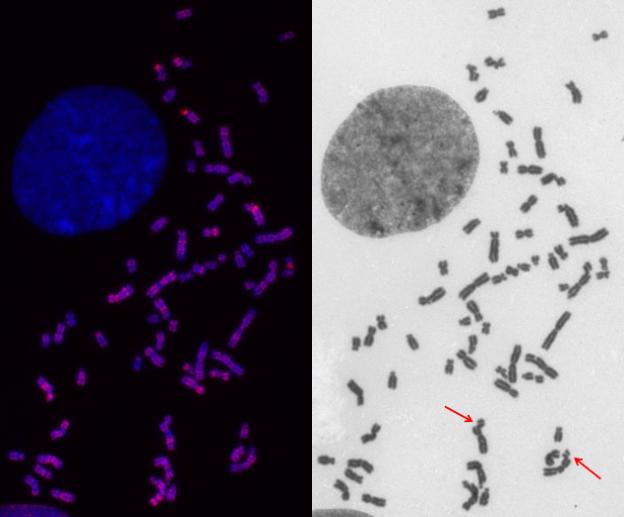 EdU-negativen und EdU-positiven Chromosomen-Spreitungen unterscheiden zu können.