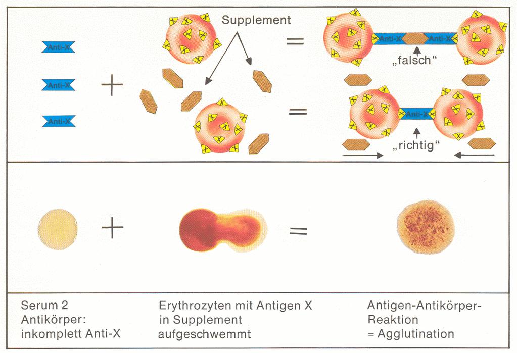 Antigen-Antikörper-Reaktionen Bestimmung inkompletter AK