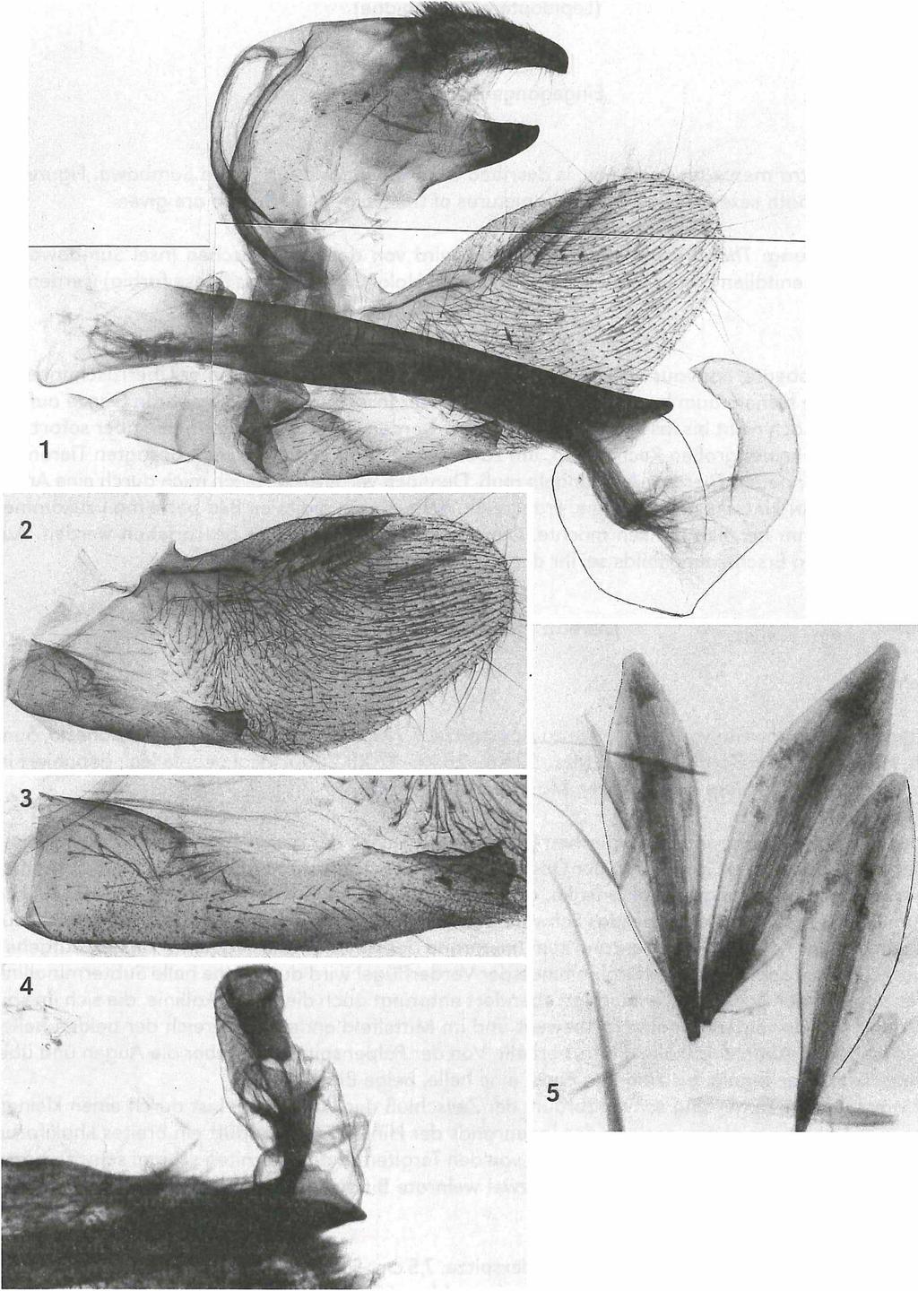 56 Eitschberger: Theretra m ercedes spec, nov., eine neue Sphingidae von Sumbawa 25* h 50* h Hl je 1 mm Tafel 1, Abb. 1-5: Theretra mercedes spec, nov., GenPräp.