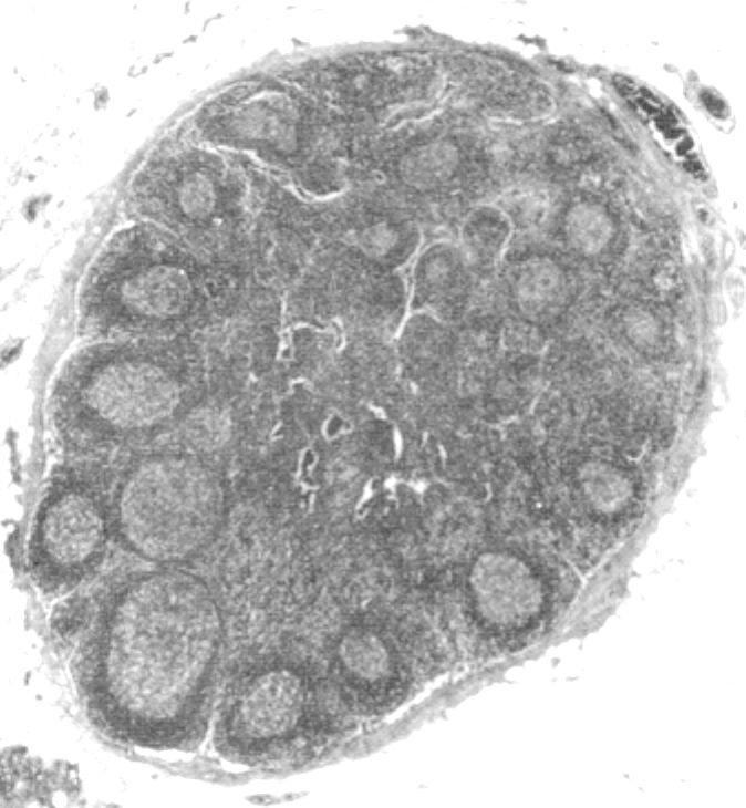 Lymphknoten Sekundärer lymphatischer Follikel (mit Keimzentrum) Keimzentrum (Aktivierung von B-Zellen) Paracortikaler Bereich (vorwiegend T-Zellen) Hohe endotheliale Venole (HEV) Primärer