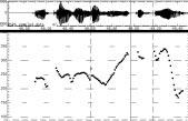 Prosodische Annotation Analysewerkzeuge H*L Gipfelakzent ; ein H-Target (lokales F 0 -Maximum) in der akzentuierten Silbe, gefolgt von einem steilen Pitchabfall in das untere Drittel des Stimmumfangs