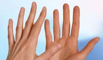 Händedesinfektion Eine umfangreiche Studie (1) ist zu dem Ergebnis gekommen, dass eine Händedesinfektion ohne gezielte Anwendung der bekannten sechs Schritte nach EN 1500 (2) nicht nur die gleiche,