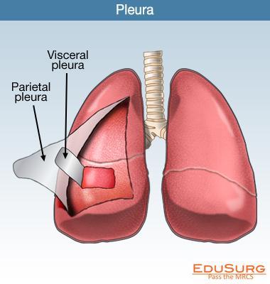 1.1.2 untere Luftwege -Pleura Umhüllt Lunge Pleuraspalt gewährleistet Verschiebbarkeit der Lunge