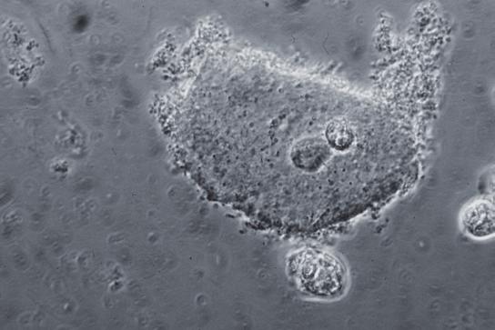 7 Stäbchenbakterienablagerung auf einer Superfizialzelle