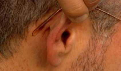 Gehörschutz Einsetzten
