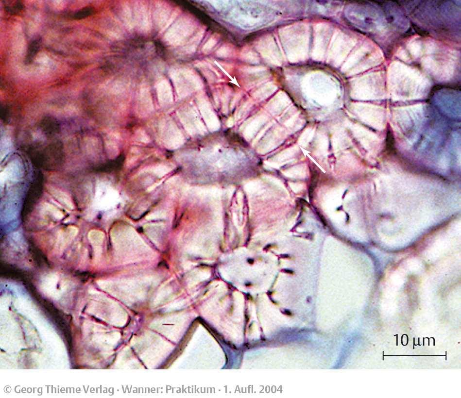 bilden Steinzellennester Verband von Steinzellen Zelllumen