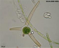 Abteilung Streptophyta Klasse Zygnematophyceae Desmediales Closterium sp.
