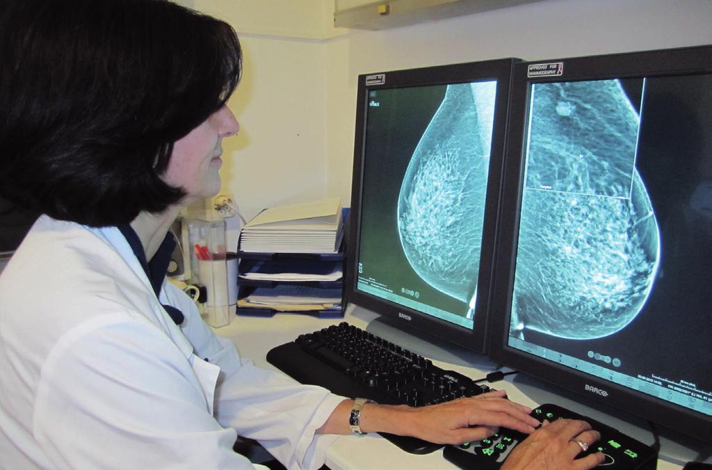 Welches sind Vorteile und Nutzen, Nachteile und Risiken der Mammografie im Rahmen eines Früherkennungsprogramms?