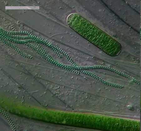 Cyanobakterien Diatomeen