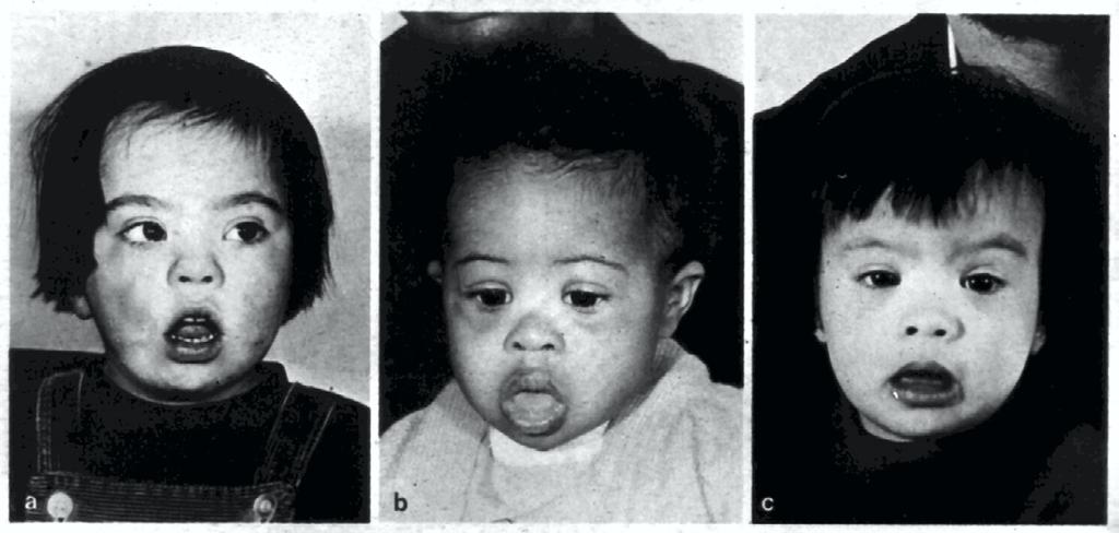 Merkmale individelle Merkmale bestimmt durch - Gesichtszüge - ethnischer Hintergrund (Herkunft) - Körperstatur - Eltern (Familie)
