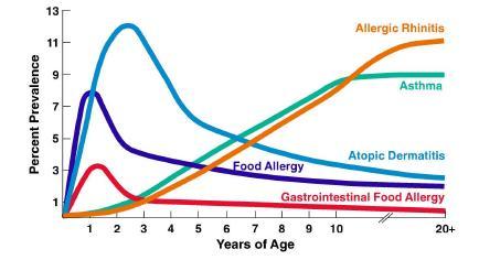 Allergische Rhinitis Wohin kann sich meine Allergie entwickeln? Jeder 3.