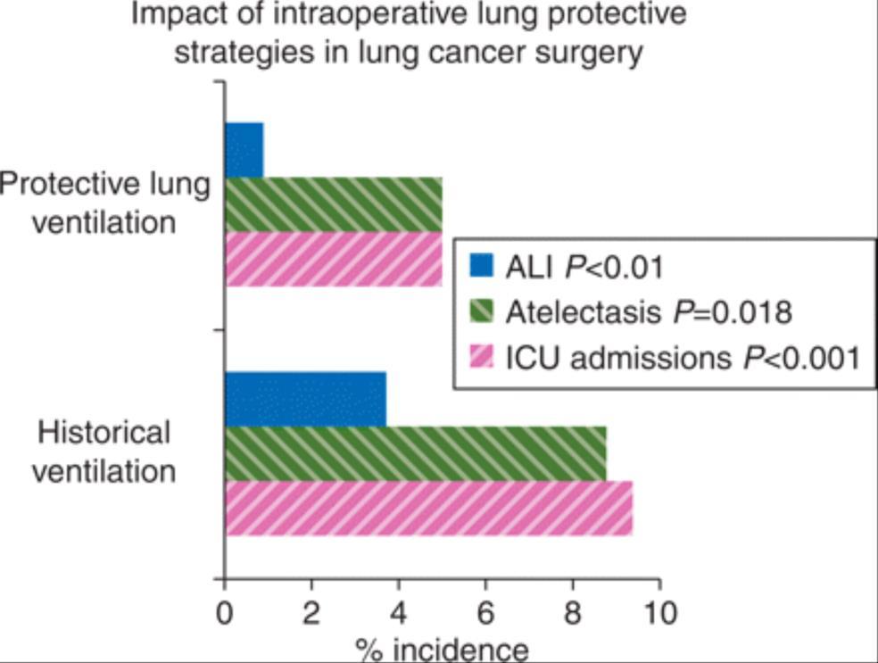 Lung protective strategies in anaesthesia Br J Anaesth. 2010;105(suppl_1):i108-i116. doi:10.1093/bja/aeq299 Figure Legend: Impact of intraoperative lung protective strategies in lung cancer surgery.