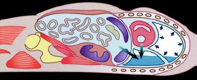 Mechanismen der Atelektasenentstehung Kompression des Lungengewebes Tonusverlust Interkostalmuskulatur Zwerchfellhochstand Resorption der