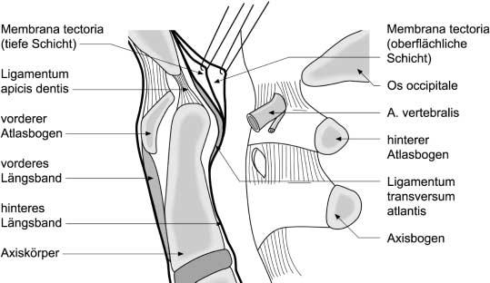 Weiterbildung Abb. 3 Der Sagittalschnitt zeigt die wichtigen Bänderbeziehungen des kraniovertebralen Überganges Wirbelverschiebung >2 mm (nicht bei Kindern!