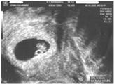 Diagnostik (PND) Abtreibung Page