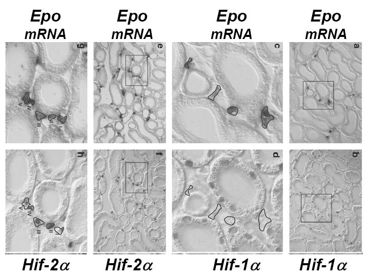 Der Hypoxia Inducible Factor 2α (HIF- 2α) bindet am Epo 3