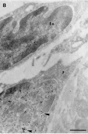 tubules Ca: Capillaries 5 µm 0.