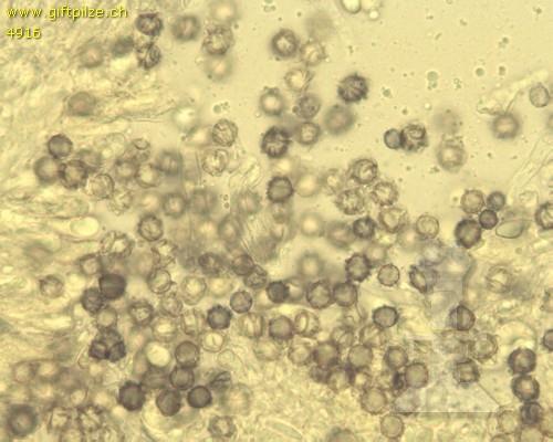 einer scharfen Spitze, 4 lecythiform, 5 kopfig, 6 moniliform, perlschnurförmig, 7 keulig, 8 Chrysozystide, spindelig, 9