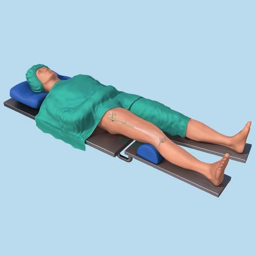 PATIENTENLAGERUNG 1 Patient lagern Den Patienten in Rückenlage auf einen Extensionstisch oder röntgenstrahlendurchlässigen OP-Tisch lagern.