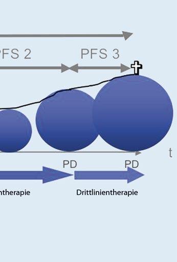 OS Gesamtüberleben, PFS progressionsfreies Überleben, PD progressive disease / Fortschreiten der Erkrankung, OP Operation Nebenwirkungen sind unter Oxaliplatin v. a. Nervenschädigungen zu erwarten.