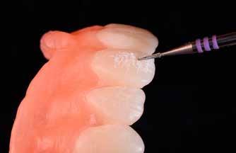 Für die Akzentuierung der Oberflächentextur der Zähne eignen sich Fräser mit Querhieb-Kreuzverzahnung für ein glattes