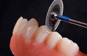 Digital Denture Für das Vorseparieren der Zähne sind