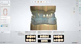 Workflow Totalprothese konstruieren Wählen Sie die gewünschte Zahnlinie und Zahngrösse gemäss Zahnarztauftrag aus.