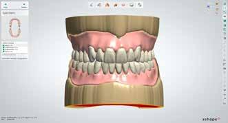 Kontrollieren Sie die Prothesendimension unter Berücksichtigung der Zahnaufstellung sowie der Lippen- und Wangenbändchen. Mit weiter gelangen Sie zur Konstruktion der Unterkiefer-Basis.