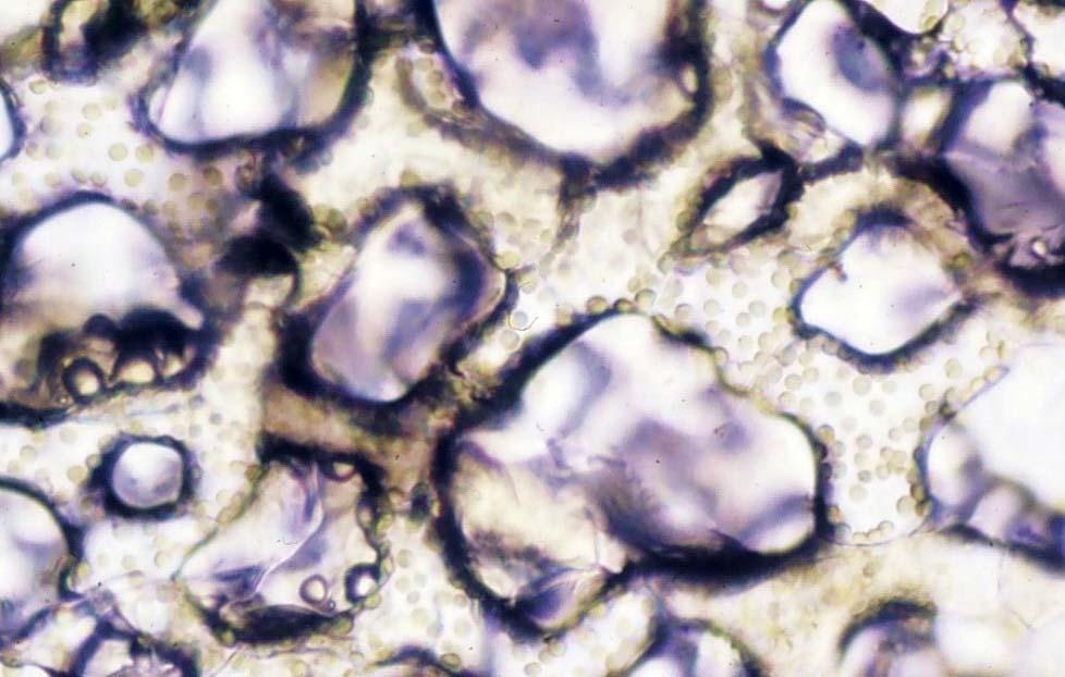 Typisches bifaciales Laubblatt einer Pflanze mit C3-Photosynthese: Helleborus niger (Christrose) Details (Flachschnitt): Schwammparenchym - Form der