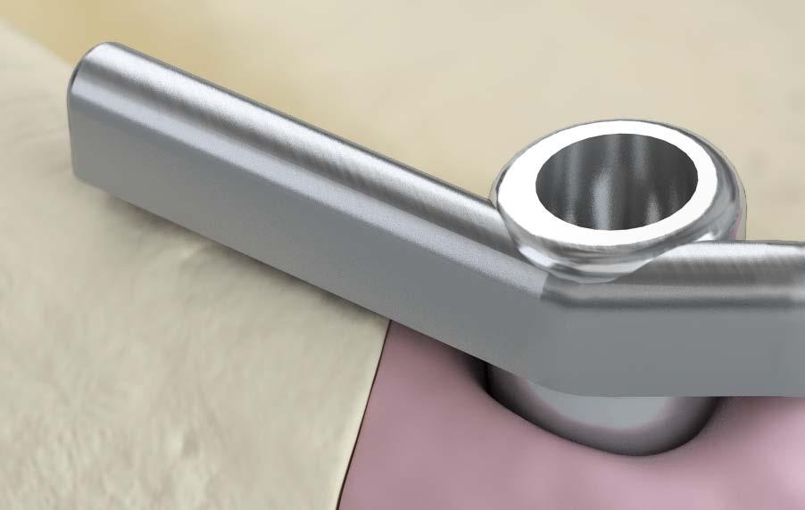 Hinweis: Maximale Spannweite zwischen zwei Implantaten: Mikro-Stegprofile: 20 mm Makro-Stegprofile: 40 mm Für weitere Informationen zu Standard-Attachment-Angaben und