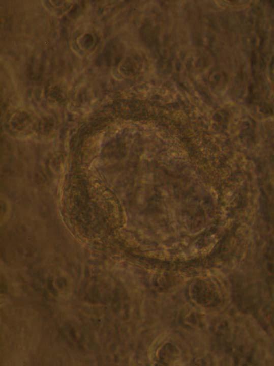 2.2.2. Kultivierung der Blastozysten auf feeder cells Trophectoderm Primitives Endoderm Innere Zellmasse Maus Blastozyst ex E4.5 5.0 2.2.2. Kultivierung der Blastozysten auf feeder cells 1.