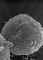 Stammzellen mit sehr großem Kern/Zytoplasma