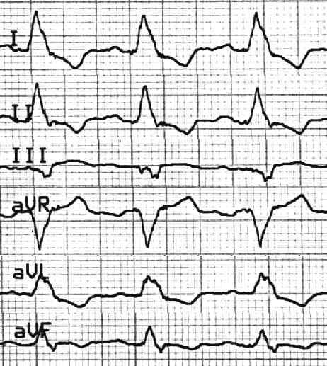 Fallstudie Nr. 1 Ein 63-jähriger Patient kommt mit Hauptbeschwerde Dyspnoe in die internistische Notaufnahme.