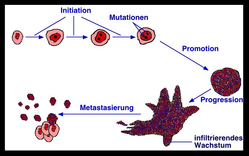 Der lange Weg von einer normalen Zelle zu einem bösartigen Tumor Mehrere Mutationen in Proliferations- und Differenzierungsgenen bewirken die Umwandlung einer normalen Zelle in eine Tumorzelle