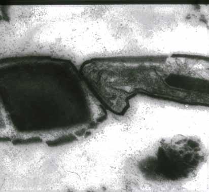 Plattenförmige Toxin-Kristalle Bacillus