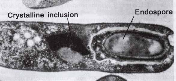 Sporulierende Zelle Aufnahme: Mycogen Corporation Bei der Sporulation bilden sich neben der Endospore ein oder mehrere