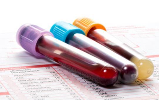 1. Untersuchungsgegenstand In-vitro-Diagnostik(a) In-vitro-Diagnostik (IVD) Persönliche Dienstleistungen und Produkte zur Analyse von Körpermaterial Diagnostika Testreagenzien (z.b.