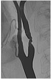 Moderne Röntgenanwendungstechniken Rö CT Angio Dr. S.