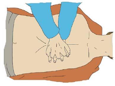 Herzdruckmassage Handposition in der Mitte der Brust
