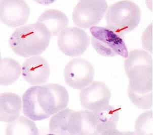 Abbildung 2: Anophelesmücke Quelle: Centers for Disease Control and Prevention (CDC) Abbildung 3: Plasmodium falciparum Zu sehen sind Formen der erythrozytären Vermehrung sowie ein Gametozyt,
