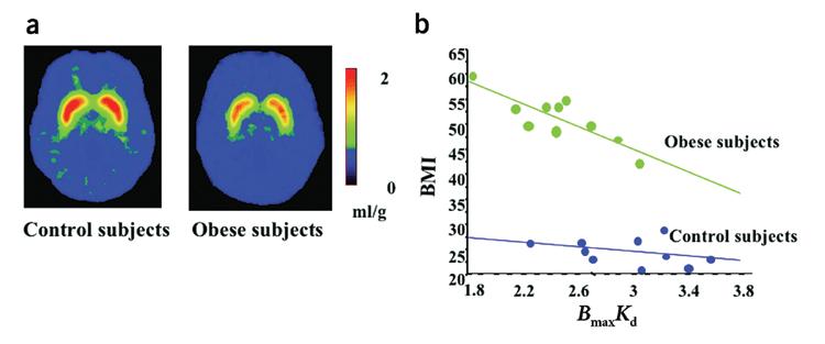 Role of dopamine D2 receptors in obesity Dopamine D2 receptors in controls and in obese