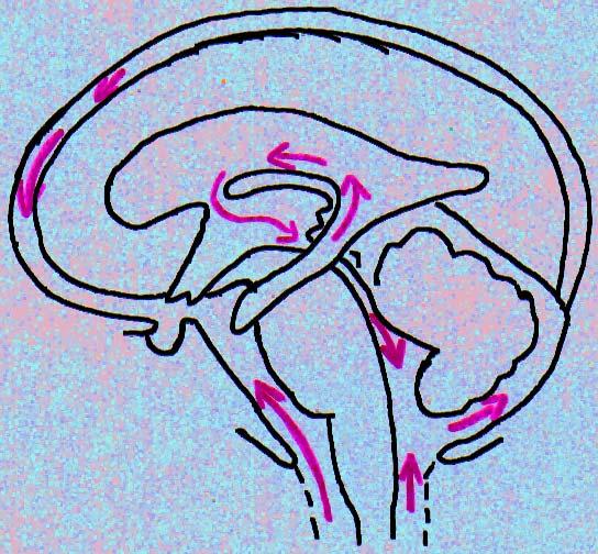ausgeprägtesten in den Basalganglien (nach medial, kaudal und okzipital) und im Hirnstamm (nach kaudal und anterior) und verursacht wesentlich den ventrikulären Ausstrom aus Seiten- und drittem