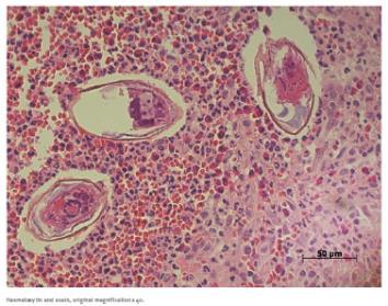 Neue diagnostische Tests für intestinale Pathogene Diagnostik zum Nachweis von S.