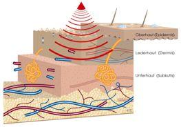 Die verschiedenen Ultraschall Frequenzen besitzen eine positive Eigenschaft auf den zellrhythmus der Haut.