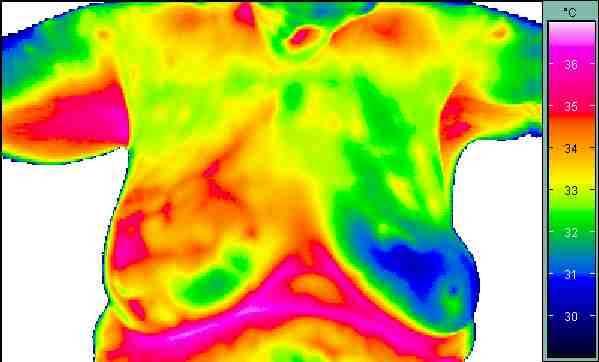 ammathermographie (Tumor-Diagnostik) IR-Thermographie essbereich: 8-10 µm Prezision: 0.