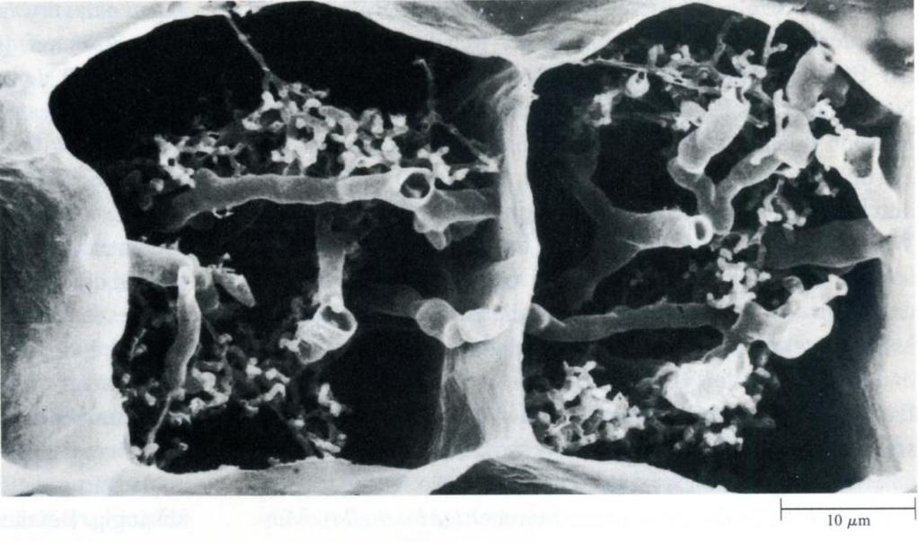Abt: Glomeromycota Ordnungen: Glomales: vesiculär arbuskuläre