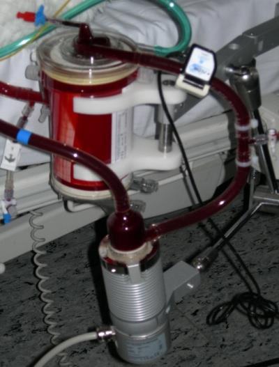 Diese Oxygenatoren, wie z.b. der Quadrox PLS, bestehen aus plasmaresistenten Polymethylpenten-Fasern und verhindern Blasenbildung.