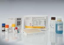 Testformate: Dipstick Kassette Real-time PCR Enthält alle erforderlichen