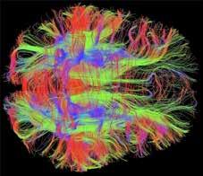 Anzeige Nervenfasern Humane im Stammzelle Gehirn www.ärzteblatt-bw.